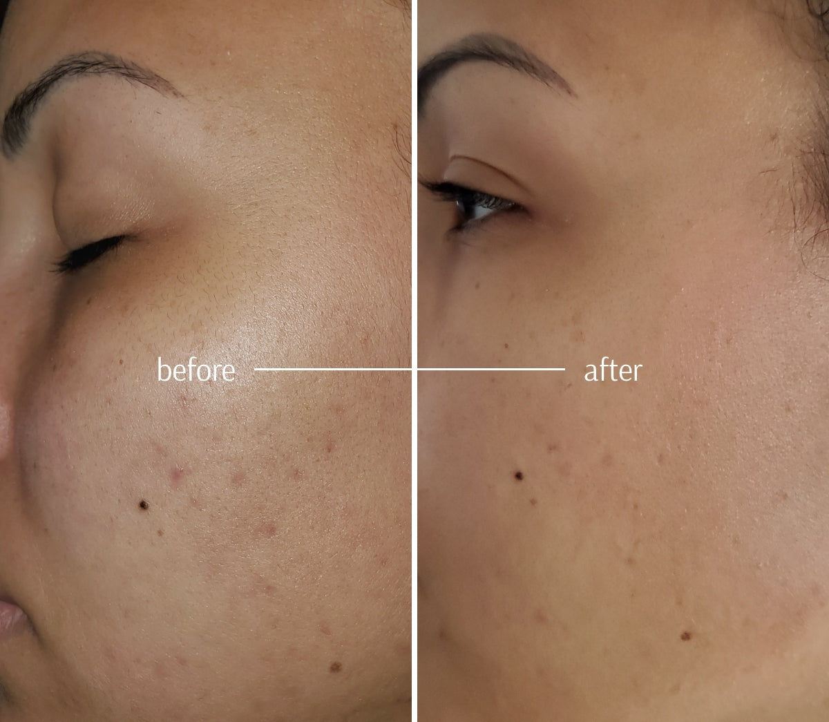 Deep Cleansing Clay Mask